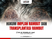 HUKUM IMPLAN RAMBUT DAN TRANSPLANTASI RAMBUT