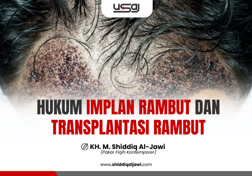 HUKUM IMPLAN RAMBUT DAN TRANSPLANTASI RAMBUT